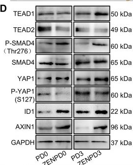 Fig.5.D showing Western Blotting from the publication: Single-cell transcriptomic profiling provides insights into the toxic effects of Zearalenone exposure on primordial follicle assembly.