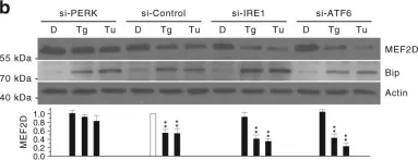 Fig.5.B showing Western Blotting in a Mus musculus (House mouse) sample from the publication: Phosphorylation of LAMP2A by p38 MAPK couples ER stress to chaperone-mediated autophagy.
