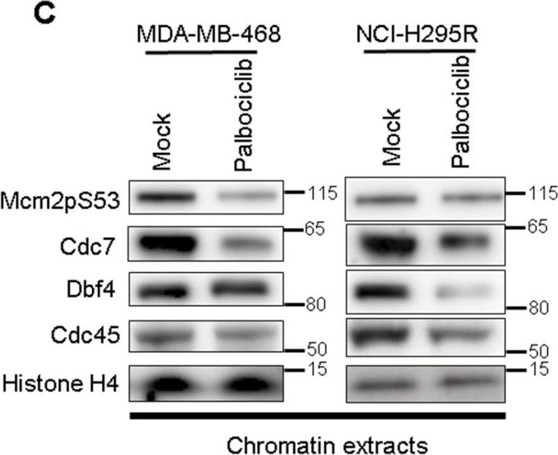 Fig.5.C showing Western Blotting in a Homo sapiens (Human) sample from the publication: Firing of Replication Origins Is Disturbed by a CDK4/6 Inhibitor in a pRb-Independent Manner.