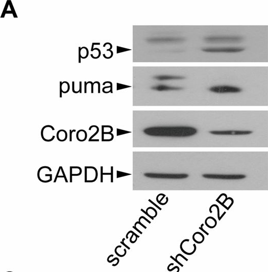 Fig.6.A showing Western Blotting from the publication: Coronin 2B deficiency induces nucleolar stress and neuronal apoptosis.