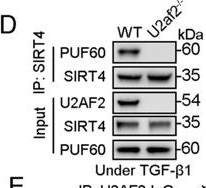 Fig.4.D showing Western Blotting from the publication: Nuclear translocation of SIRT4 mediates deacetylation of U2AF2 to modulate renal fibrosis through alternative splicing-mediated upregulation of CCN2.