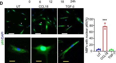 Fig.5.D showing Immunocytochemistry-immunofluorescence from the publication: CCL18 signaling from tumor-associated macrophages activates fibroblasts to adopt a chemoresistance-inducing phenotype.