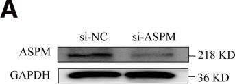 Fig.2.A showing Western Blotting in a Homo sapiens (Human) sample from the publication: ASPM promotes the progression of ovarian endometriosis by modulating the cell cycle and activating the Wnt/β-catenin signaling pathway.