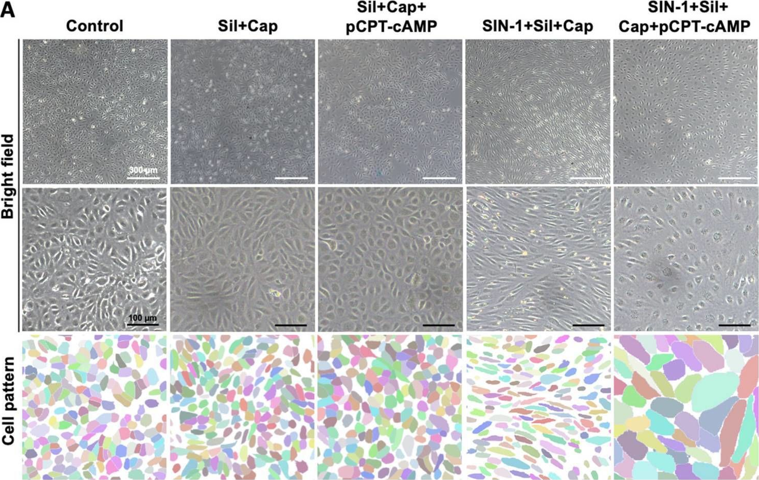 Fig.3.A showing Immunohistochemistry from the publication: Combined Pharmacological Conditioning of Endothelial Cells for Improved Vascular Graft Endothelialization.