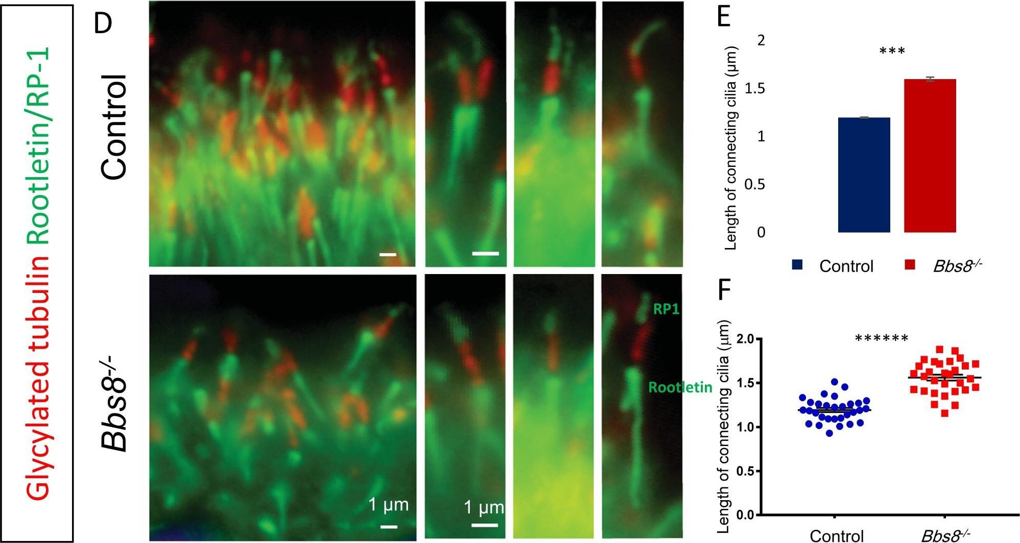Fig.3.D showing Immunohistochemistry in a Mus musculus (House mouse) sample from the publication: BBSome function is required for both the morphogenesis and maintenance of the photoreceptor outer segment.