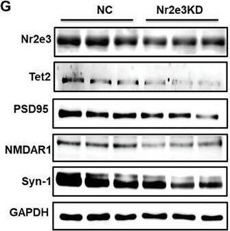 Fig.7.G showing Western Blotting from the publication: Targeting Nr2e3 to Modulate Tet2 Expression: Therapeutic Potential for Depression Treatment.