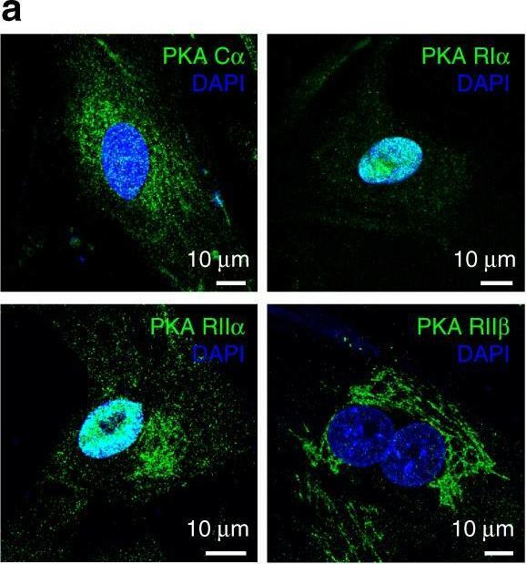 Fig.4.A showing Immunocytochemistry-immunofluorescence from the publication: Internalized TSH receptors en route to the TGN induce local Gs-protein signaling and gene transcription.