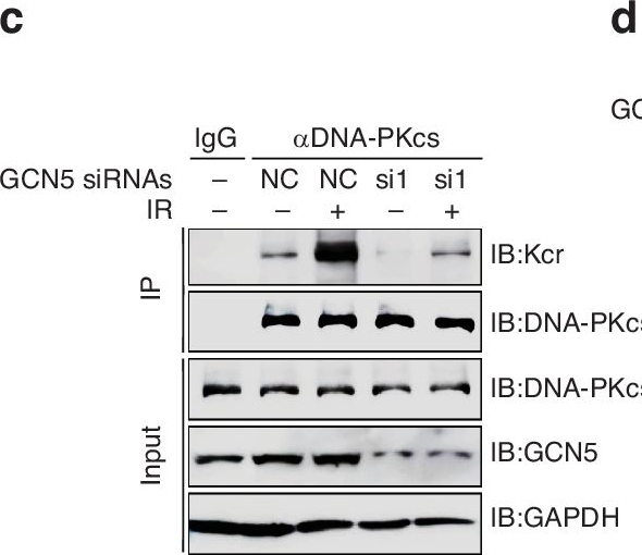 Fig.6.C showing Western Blotting in a Homo sapiens (Human) sample from the publication: GCN5 mediates DNA-PKcs crotonylation for DNA double-strand break repair and determining cancer radiosensitivity.