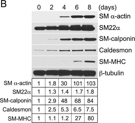 Fig.1.B showing Western Blotting in a Homo sapiens (Human) sample from the publication: Fibroblast growth factor (FGF) signaling regulates transforming growth factor beta (TGFβ)-dependent smooth muscle cell phenotype modulation.