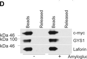 Fig.2.D showing Western Blotting from the publication: Impaired malin expression and interaction with partner proteins in Lafora disease.