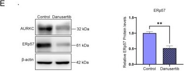 Fig.6.E showing Western Blotting from the publication: AURKC Promotes Clear Cell Renal Cell Carcinoma Proliferation Through Upregulation of ERp57.