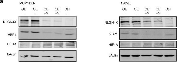 Fig.5.A showing Western Blotting from the publication: Late stage melanoma is hallmarked by low NLGN4X expression leading to HIF1A accumulation.