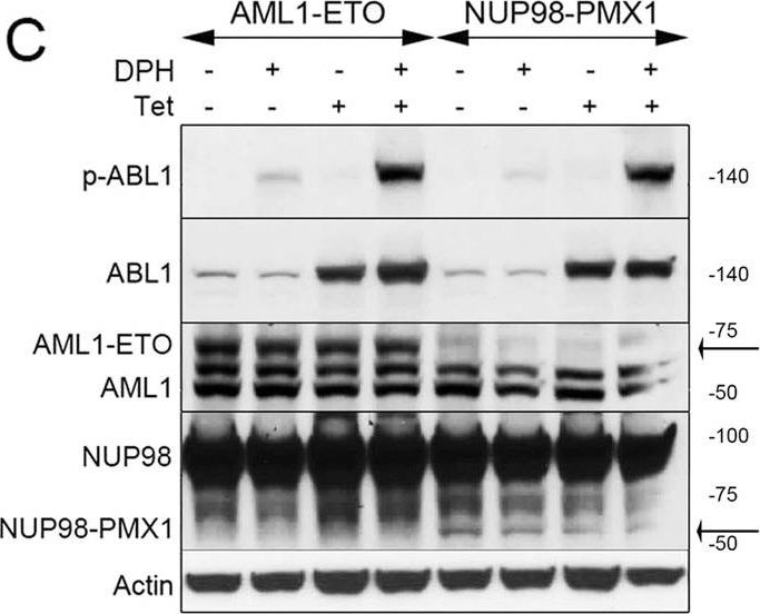 Fig.2.C showing Western Blotting in a Mus musculus (House mouse) sample from the publication: ABL1 kinase as a tumor suppressor in AML1-ETO and NUP98-PMX1 leukemias.
