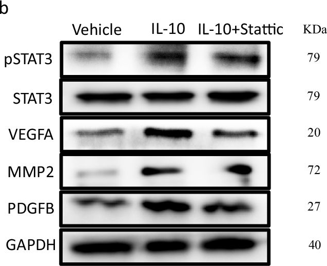 Fig.10.B showing Western Blotting from the publication: Senescent-like macrophages mediate angiogenesis for endplate sclerosis via IL-10 secretion in male mice.