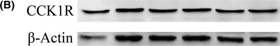 Fig.2.B showing Western Blotting from the publication: Inhibitory effect of high leucine concentration on α-amylase secretion by pancreatic acinar cells: possible key factor of proteasome.