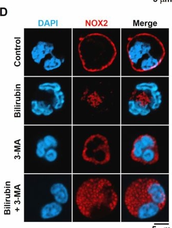 Fig.8.D showing Immunocytochemistry-immunofluorescence from the publication: Bilirubin reduces mortality in sepsis models by inhibiting NOX2-mediated formation of neutrophil extracellular traps.
