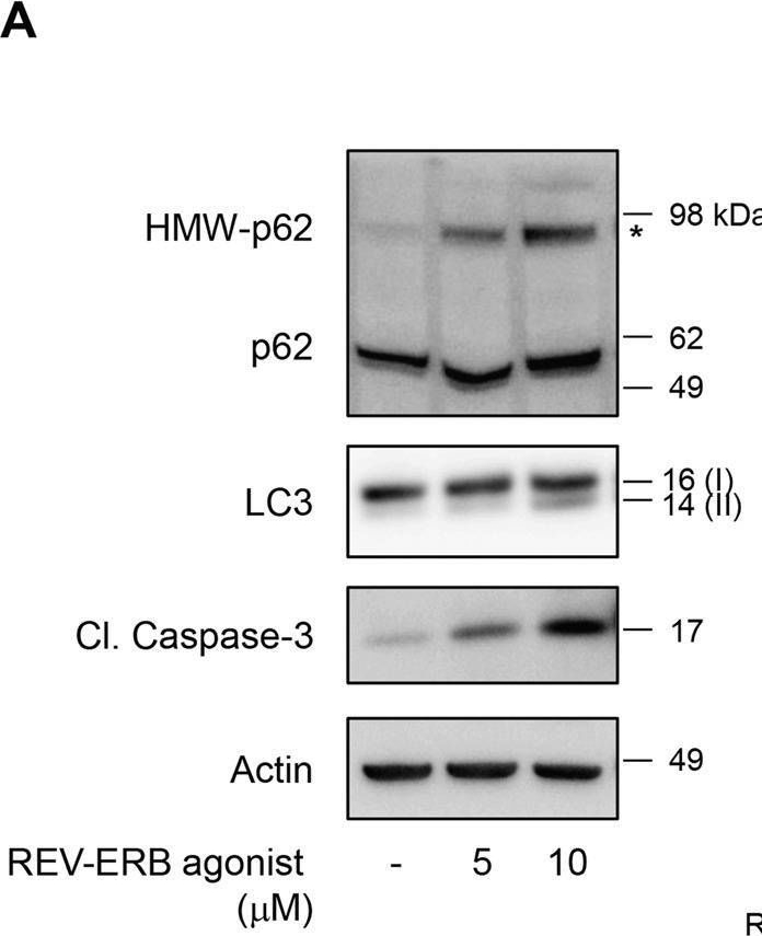 The nuclear receptor REV-ERBα is implicated in the alteration of β-cell autophagy and survival under diabetogenic conditions.