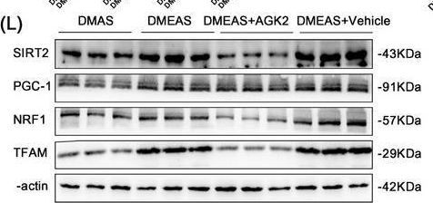 Fig.5.L showing Western Blotting from the publication: Swimming Exercise Pretreatment Attenuates Postoperative Delirium-Like Behavior in Type 2 Diabetic Rats by Enhancing Mitochondrial Biogenesis Through Activation of SIRT2 Deacetylation.