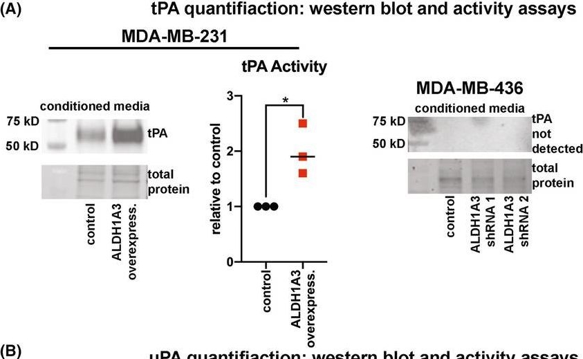 Fig.3.A showing Western Blotting in a Homo sapiens (Human) sample from the publication: ALDH1A3 promotes invasion and metastasis in triple-negative breast cancer by regulating the plasminogen activation pathway.