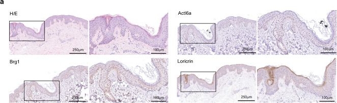 Fig.1.A showing Immunohistochemistry from the publication: Involvement of transcribed lncRNA uc.291 and SWI/SNF complex in cutaneous squamous cell carcinoma.