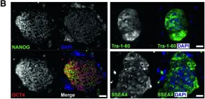 Fig.1.B showing Immunocytochemistry-immunofluorescence in a Homo sapiens (Human) sample from the publication: A new patient-derived iPSC model for dystroglycanopathies validates a compound that increases glycosylation of α-dystroglycan.