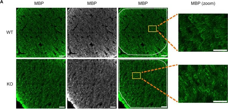 Fig.8.A showing Immunohistochemistry-immunofluorescence in a Mus musculus (House mouse) sample from the publication: Synaptic alterations are preceding the axonal loss in optic atrophy of Wolfram syndrome mouse model.