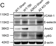 Fig.2.C showing Western Blotting from the publication: Annexin A2 Deficiency Exacerbates Neuroinflammation and Long-Term Neurological Deficits after Traumatic Brain Injury in Mice.