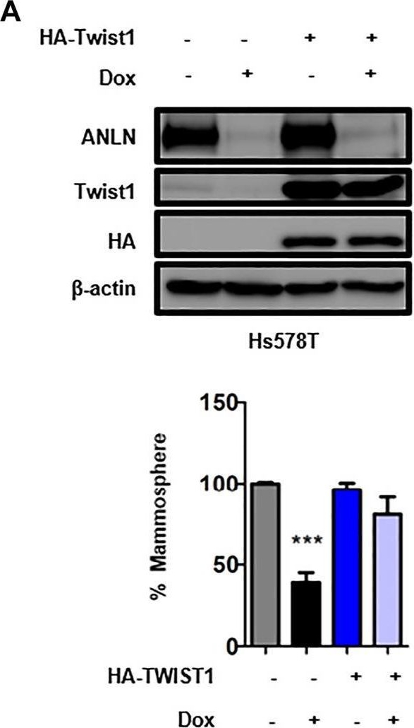 Fig.4.A showing Western Blotting in a Homo sapiens (Human) sample from the publication: ANLN Enhances Triple-Negative Breast Cancer Stemness Through TWIST1 and BMP2 and Promotes its Spheroid Growth.