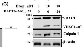 Fig.4.G showing Western Blotting from the publication: Etoposide-induced cancer cell death: roles of mitochondrial VDAC1 and calpain, and resistance mechanisms.