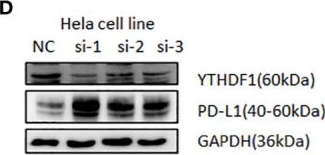 Fig.12.D showing Western Blotting in a Homo sapiens (Human) sample from the publication: Comprehensive characterization of tumor microenvironment and m6A RNA methylation regulators and its effects on PD-L1 and immune infiltrates in cervical cancer.