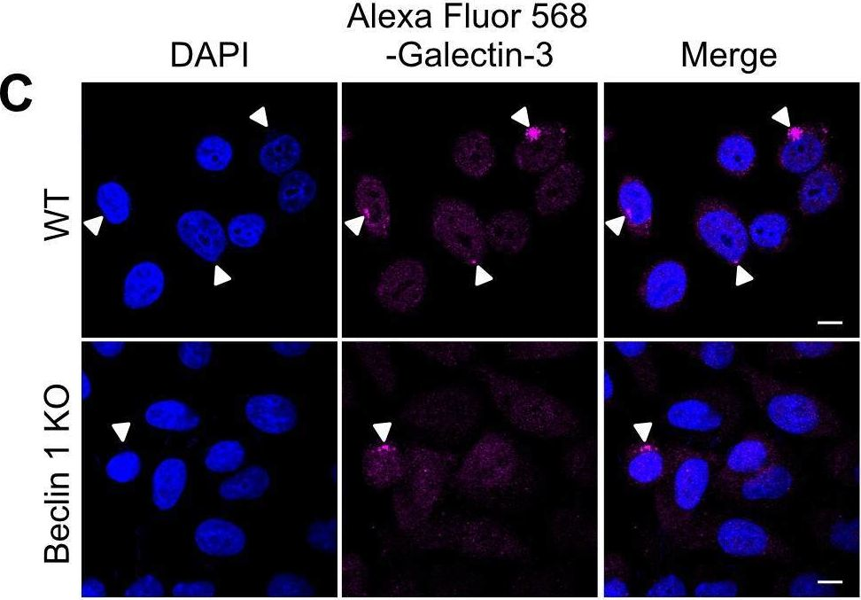 Fig.3.C showing Immunocytochemistry-immunofluorescence from the publication: Bcl-xL Affects Group A Streptococcus-Induced Autophagy Directly, by Inhibiting Fusion between Autophagosomes and Lysosomes, and Indirectly, by Inhibiting Bacterial Internalization via Interaction with Beclin 1-UVRAG.