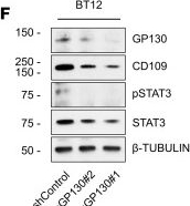 Fig.3.F showing Western Blotting from the publication: CD109-GP130 interaction drives glioblastoma stem cell plasticity and chemoresistance through STAT3 activity.