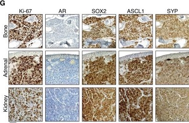 Fig.7.G showing Immunohistochemistry in a Mus musculus (House mouse) sample from the publication: Integrative molecular analyses of lineage identity and morphology in aggressive variant prostate cancer.