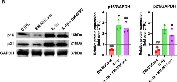 Fig.8.B showing Western Blotting in a Homo sapiens (Human) sample from the publication: Pre-Conditioned Bone Marrow Mesenchymal Stromal Cell-Derived Secretome Exerts an Anti-Inflammatory Effect on Degenerative Nucleus Pulposus Cells In&nbsp;Vitro.