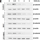 Fig.2.E showing Western Blotting in a Homo sapiens (Human) sample from the publication: Targeting the Endothelin-1 pathway to reduce invasion and chemoresistance in gallbladder cancer cells.