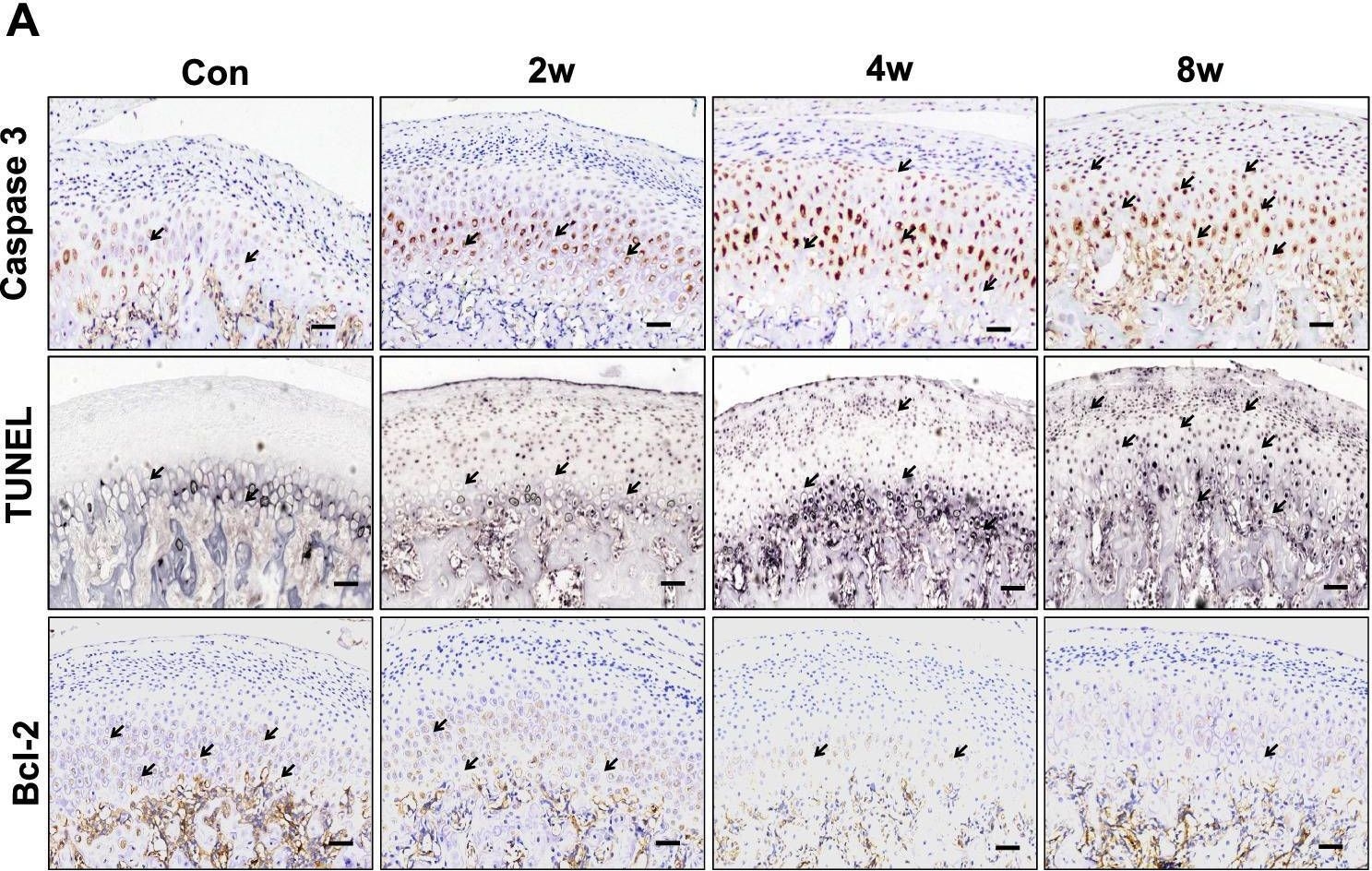Fig.4.A showing Immunohistochemistry in a Rattus norvegicus (Rat) sample from the publication: Hypoxia-inducible factor expression is related to apoptosis and cartilage degradation in temporomandibular joint osteoarthritis.