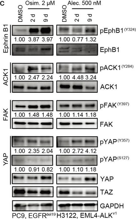 Fig.3.C showing Western Blotting in a Homo sapiens (Human) sample from the publication: Focal adhesion kinase-YAP signaling axis drives drug-tolerant persister cells and residual disease in lung cancer.