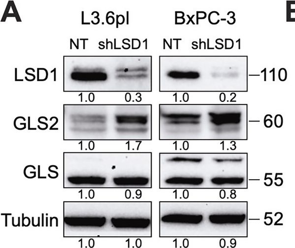 Fig.6.A showing Western Blotting from the publication: LSD1-GLS2 axis drives subtype-specific chemoresistance in pancreatic cancer through glutaminolysis reprogramming.