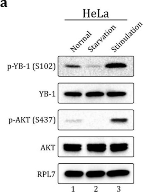 Fig.1.A showing Western Blotting from the publication: YB-1 Phosphorylation at Serine 209 Inhibits Its Nuclear Translocation.