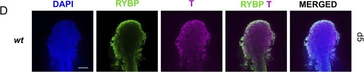 Fig.8.D showing Immunohistochemistry-immunofluorescence in a Mus musculus (House mouse) sample from the publication: Brachyury co-operates with polycomb protein RYBP to regulate gastrulation and axial elongation in vitro.
