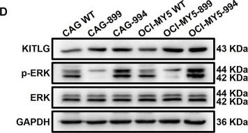 Fig.6.D showing Western Blotting from the publication: DAZAP1 facilitates the alternative splicing of KITLG to promote multiple myeloma cell proliferation via ERK signaling pathway.