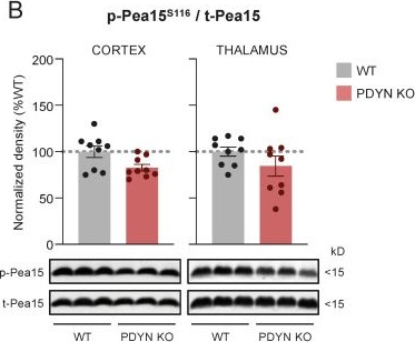 Fig.3.B showing Western Blotting in a Mus musculus (House mouse) sample from the publication: Regulation of Cortico-Thalamic JNK1/2 and ERK1/2 MAPKs and Apoptosis-Related Signaling Pathways in PDYN Gene-Deficient Mice Following Acute and Chronic Mild Stress.