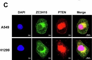 Fig.4.C showing Immunocytochemistry-immunofluorescence in a Homo sapiens (Human) sample from the publication: ZC3H15 regulates the ubiquitination of PTEN via recruitment of TRIM56 and promotes malignant progression of non-small cell lung cancer.