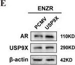 Fig.6.E showing Western Blotting from the publication: NDR1 enhances USP9X-mediated AR deubiquitination and promotes enzalutamide resistance in castration-resistant prostate cancer.