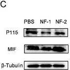 Fig.4.C showing Western Blotting in a Mus musculus (House mouse) sample from the publication: Tailoring Tumor Cell Golgi Apparatus-Targeting Self-Assembled Peptide for Effective Immunotherapy via Reshaping MIF-Mediated Immunosuppressive Network.