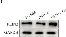 Fig.2.D showing Western Blotting from the publication: FABP3 Mediates Lipid Droplet Accumulation and Adhesive Capacity in Bovine Endometrial Epithelial Cells via PGE2/PTGER4/PPAR Axis.