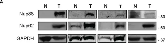 Fig.1.A showing Western Blotting from the publication: Overexpressed Nup88 stabilized through interaction with Nup62 promotes NF-κB dependent pathways in cancer.