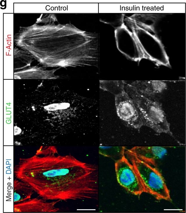 Fig.2.G showing Immunohistochemistry-immunofluorescence in a Homo sapiens (Human) sample from the publication: 3D organoid-derived human glomeruli for personalised podocyte disease modelling and drug screening.