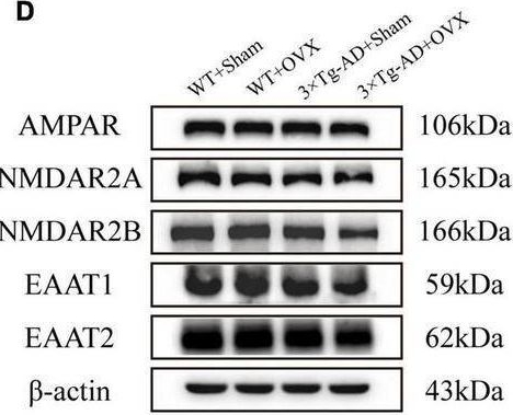 Fig.8.D showing Western Blotting in a Mus musculus (House mouse) sample from the publication: Ovariectomy exacerbates the disturbance of excitation- inhibition balance in the brain of APP/PS-1/tau mice.