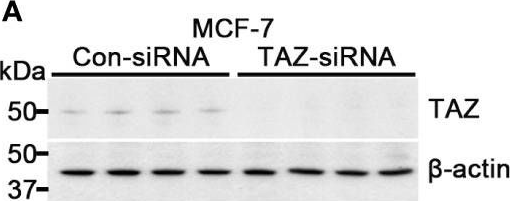 Fig.1.A showing Western Blotting in a Homo sapiens (Human) sample from the publication: TAZ is involved in breast cancer cell migration via regulating actin dynamics.